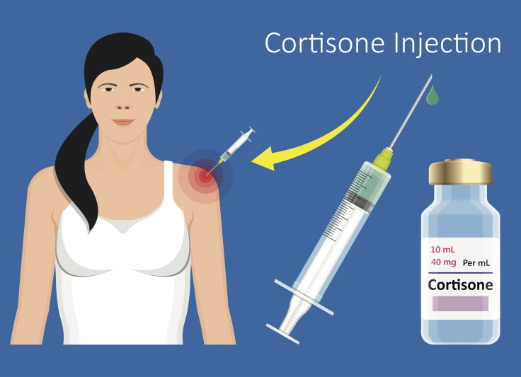cortisone injections