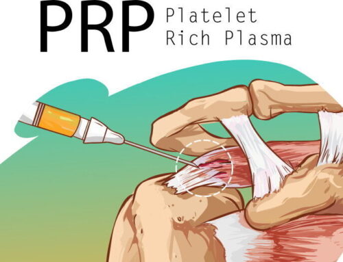 PRP injection shoulder: is it an option for shoulder pain?